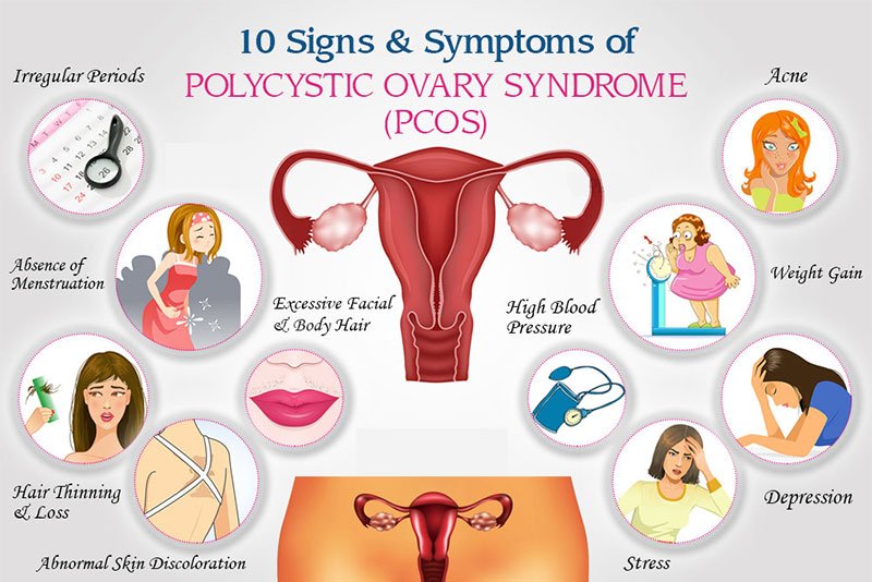 pcos signs